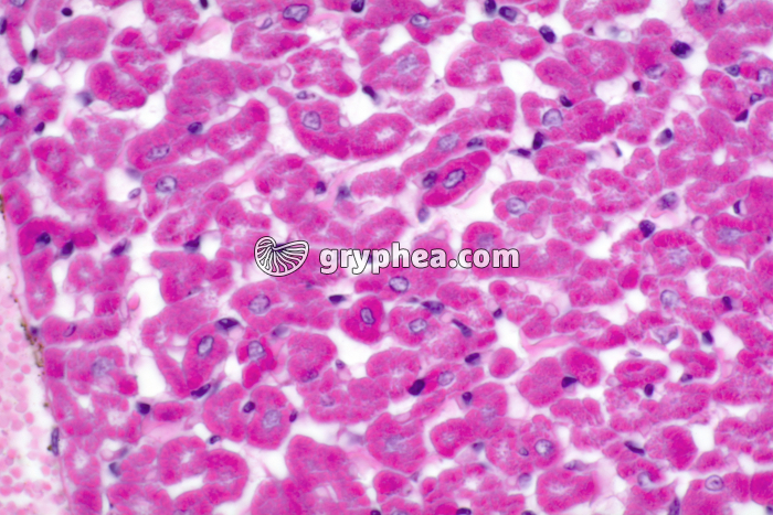 Fibres musculaires cardiaques CT x200 - gryphea.com